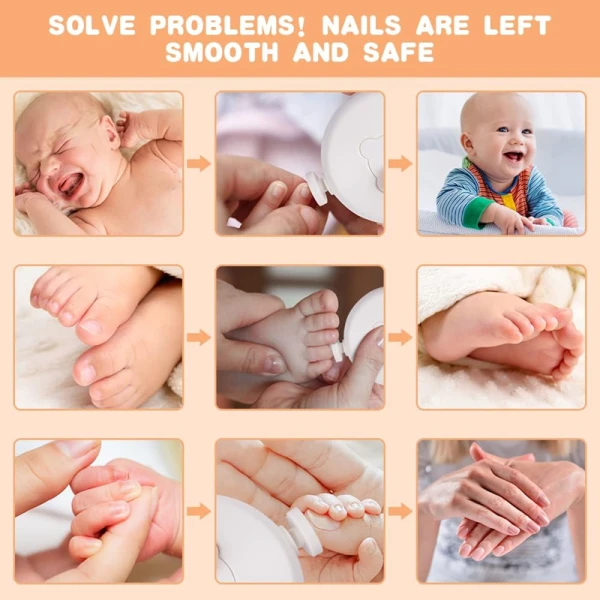 a1702273a08e096f7be020a7ee1c9135.png